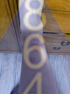 Imagen de picadura de chinches en la piel - Ejemplo 4