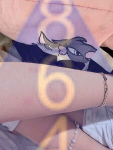 Imagen de picadura de chinches en la piel - Ejemplo 5